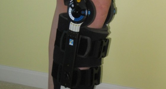 Bionic Leg